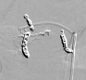 Angiographie (KM)